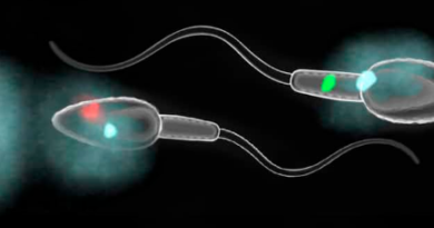 Aneuploidie spermatiche e infertilità maschile