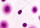 Test di frammentazione del DNA e aneuploidie in spermatozoi umani