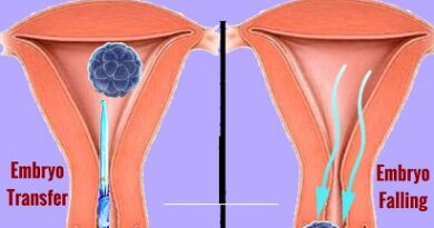 Ruolo immunologico delle interleuchine nel fallimento ripetuto di impianto