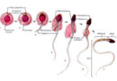 Biomarcatori della qualità degli spermatozoi nell’infertilità inspiegata