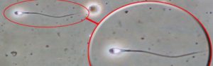 Lo spermiogramma, collaborazione tra clinici e biologi